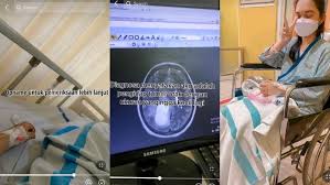 Fenomena 'Pasien TikTok': Sakit Kepala Dikit, Langsung Cek Gejala di TikTok, Auto Divonis Tumor Otak, Panik Setengah Mati